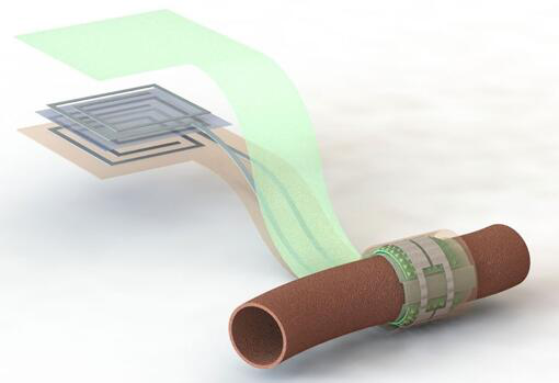 上圖描繪了這款可生物降解的壓力傳感器，它圍繞著一根血管，天線在左側(分離的層狀結構，展示了天線結構的細節)